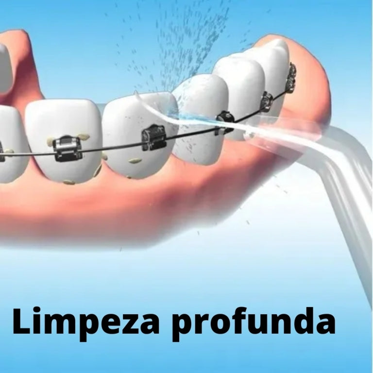 Waterpik Jato D Água Limpador Irrigador Bucal Dentes Gengiva